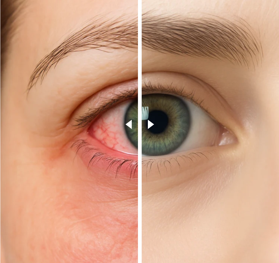 VapOculaire™ - Buse vapeur pour hydrater les yeux secs et le visage