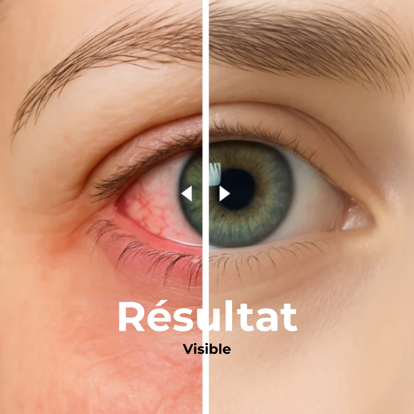 VapOculaire™ - Buse vapeur pour hydrater les yeux secs et le visage