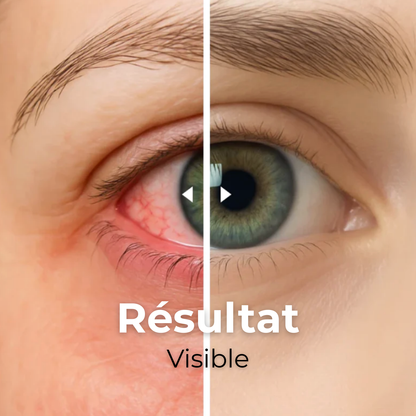 VapOculaire™ - Buse vapeur pour hydrater les yeux secs et le visage -55%