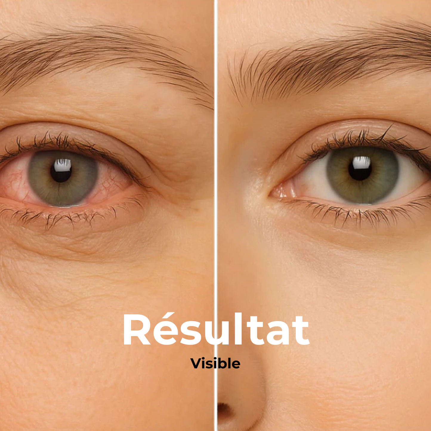 VapOculaire™ - Buse vapeur pour hydrater les yeux secs et le visage