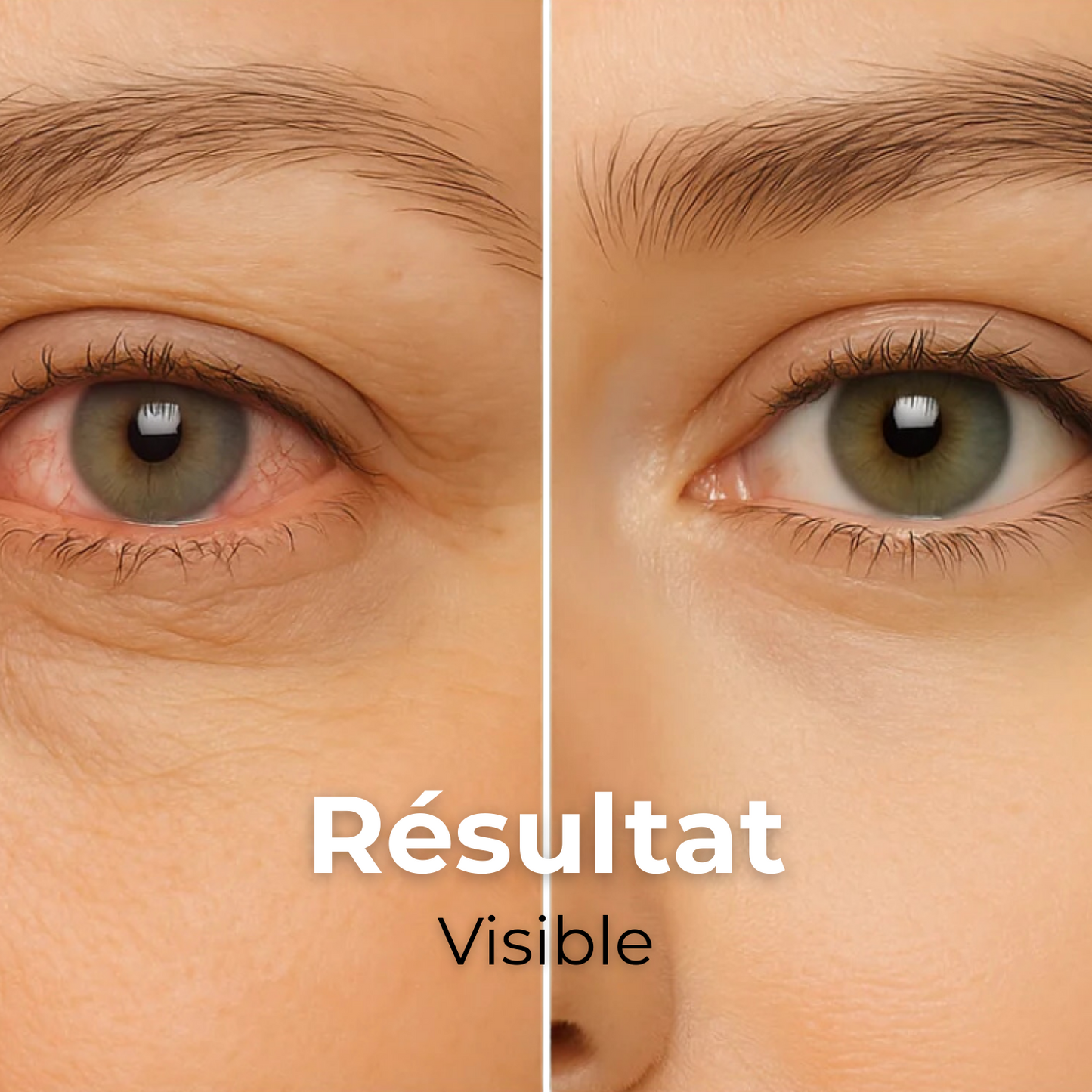VapOculaire™ - Buse vapeur pour hydrater les yeux secs et le visage -55%