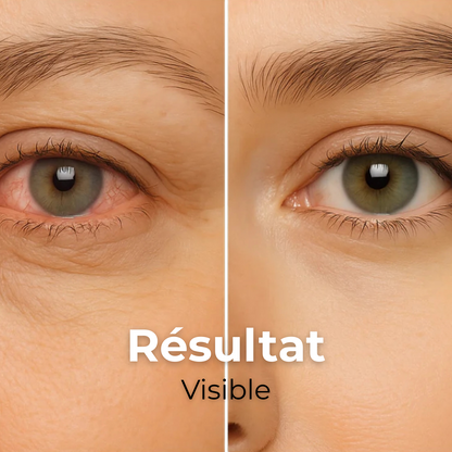 VapOculaire™ - Buse vapeur pour hydrater les yeux secs et le visage -55%